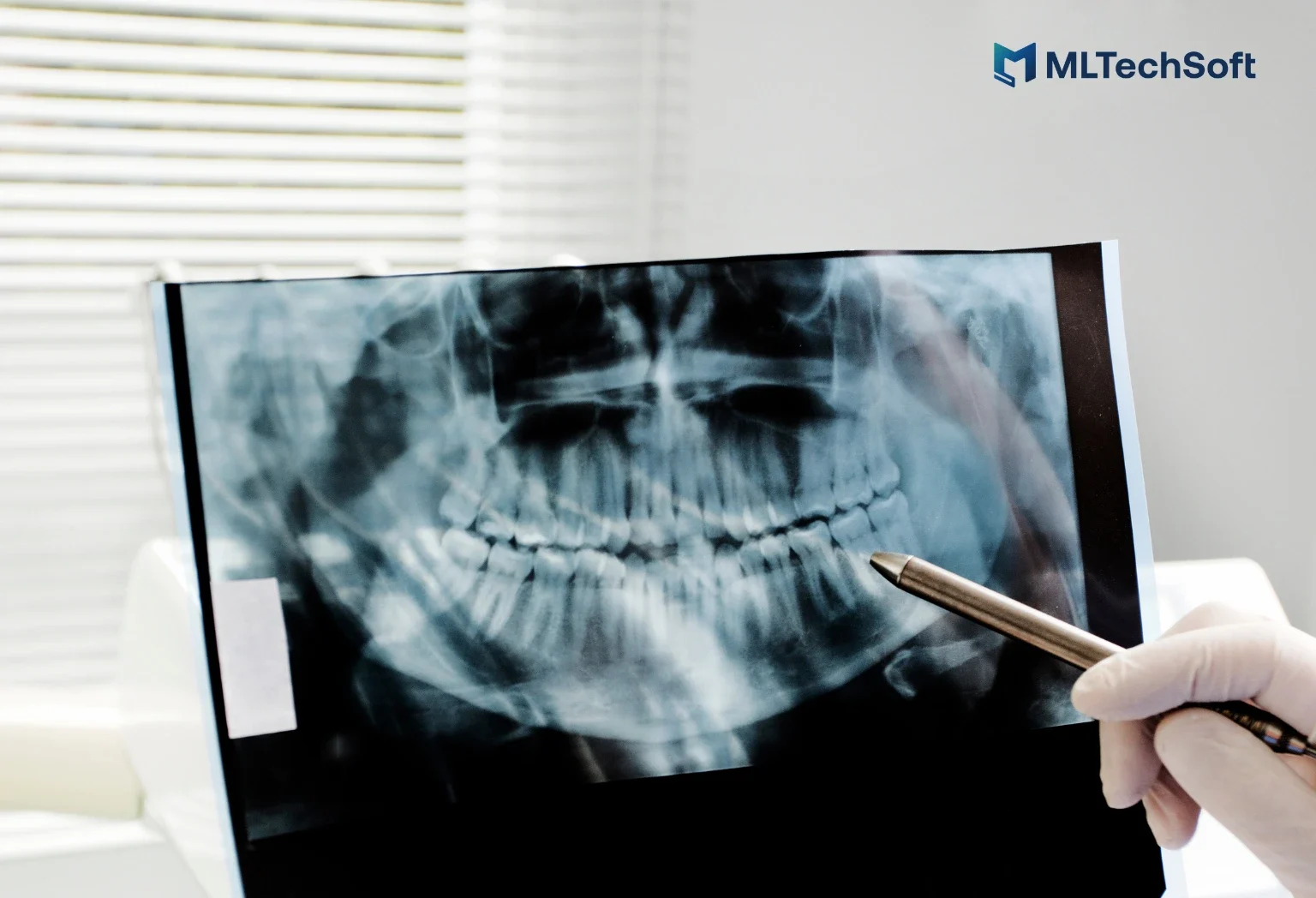 A dentist at V-Dental reviewing a traditional dental X-ray without assistance tools.